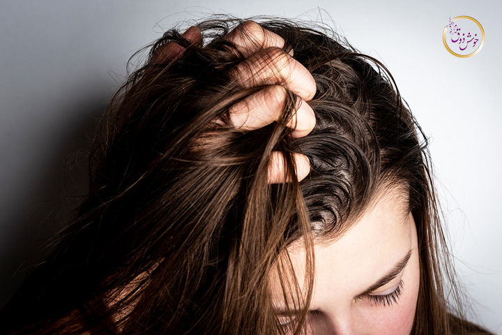 علت چربی موی سر چیست؟